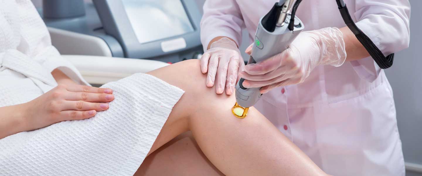 Epilasyon Nedir?